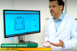 protesesilicone 270x180 1