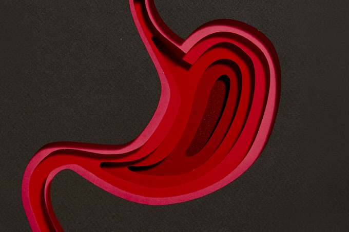 h&eacute;rnia de hiato