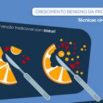 cirurgia prostata crescimento benigno da próstata