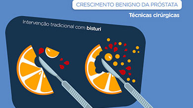 cirurgia prostata crescimento benigno da próstata