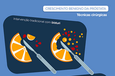 cirurgia prostata crescimento benigno da pr&oacute;stata