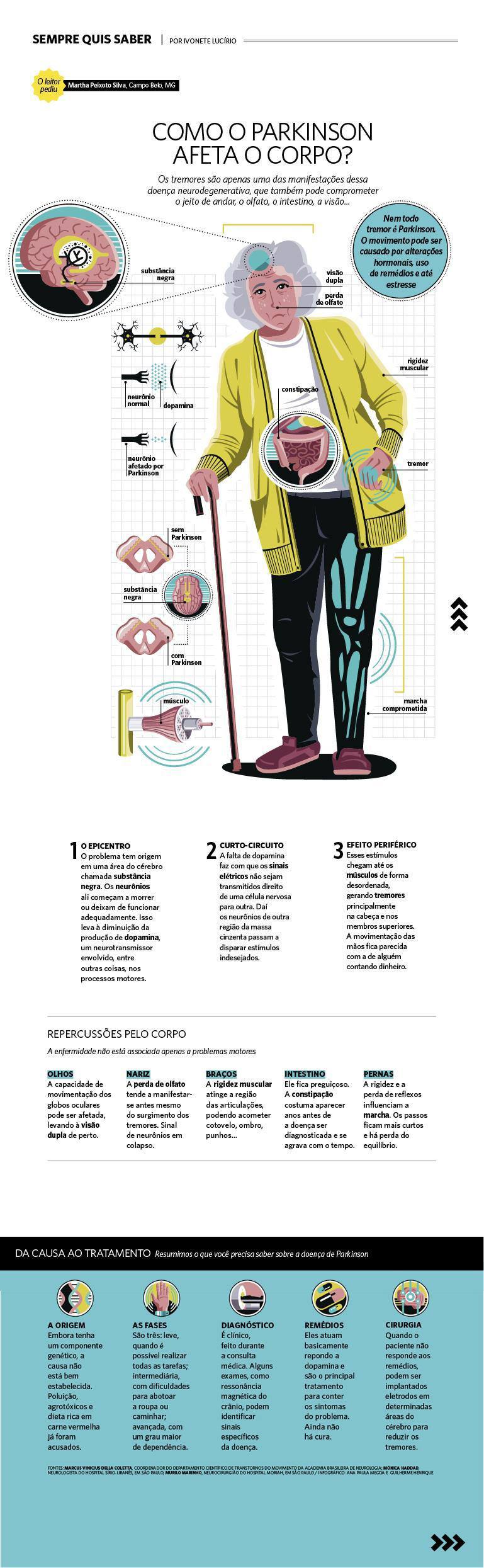 Como Parkinson afeta seu corpo