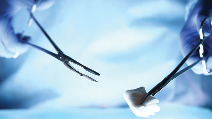 objetos intracavitários