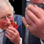 condição que afeta o rei Charles