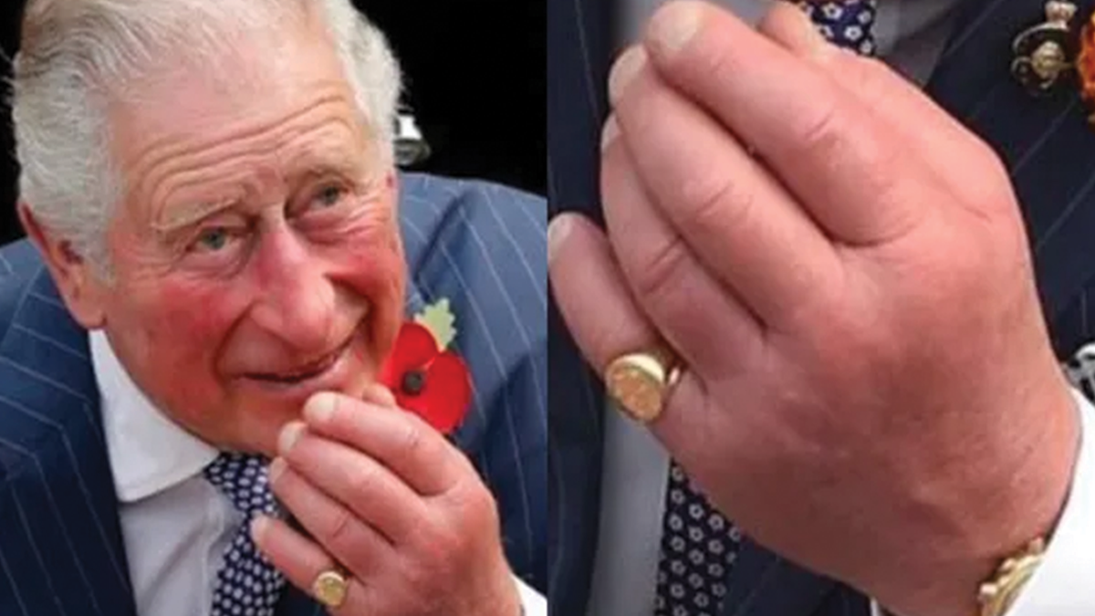 condição que afeta o rei Charles