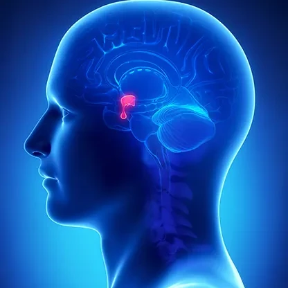 Cirurgia de Hipófise