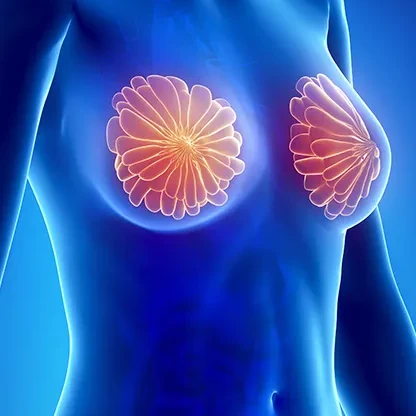 Cirurgia Mamária