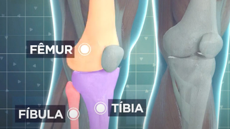 Equipamento robotizado promete aumentar eficiência das cirurgias ortopédicas