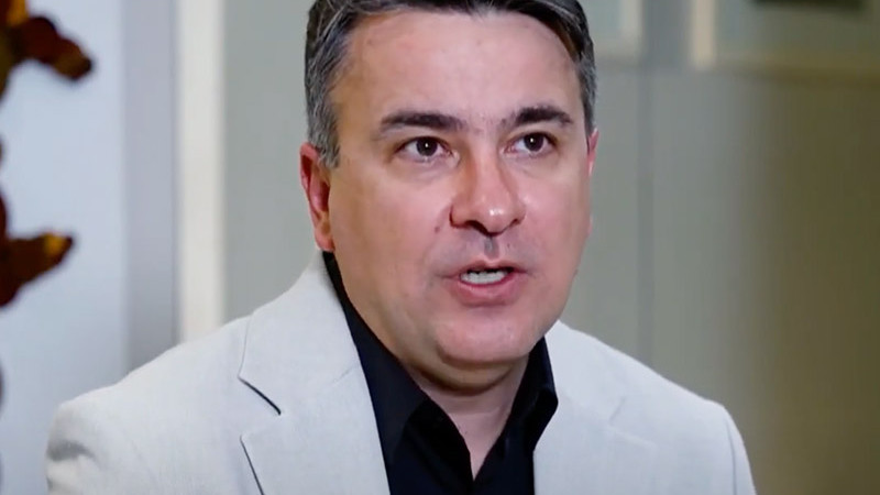 Conheça a técnica que transplanta fios dos cabelos para a região dos cílios